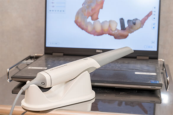 幅広い治療でお口のお悩みに対応