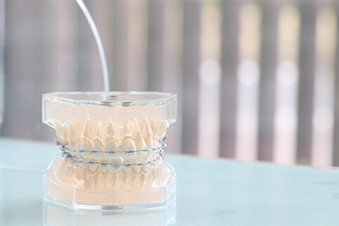 一般矯正について